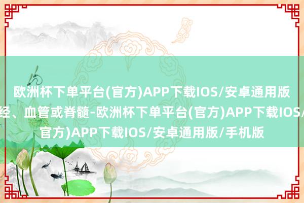 欧洲杯下单平台(官方)APP下载IOS/安卓通用版/手机版可能压迫神经、血管或脊髓-欧洲杯下单平台(官方)APP下载IOS/安卓通用版/手机版